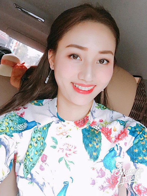 Không cần dao kéo, chỉ cần niềng răng, dàn mỹ nhân VBiz đã thăng hạng nhan sắc như thế nào? - Ảnh 14. Không cần dao kéo, chỉ cần niềng răng, dàn mỹ nhân VBiz đã thăng hạng nhan sắc như thế nào? - Ảnh 14.