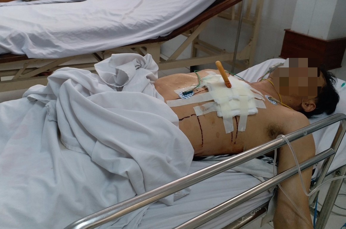 Người đàn ông tự lấy dao đâm vào tim mình - Ảnh 1. Người đàn ông tự lấy dao đâm vào tim mình - Ảnh 1.