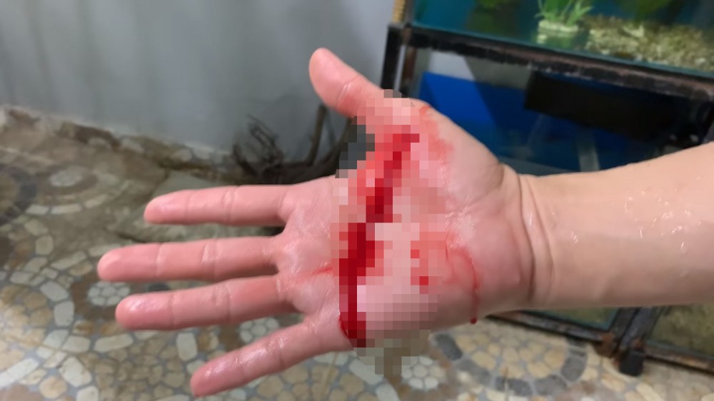 Đan Trường bị cá hổ Piranha cắn chảy máu tay không ngừng - Ảnh 1. Đan Trường bị cá hổ Piranha cắn chảy máu tay không ngừng - Ảnh 1.