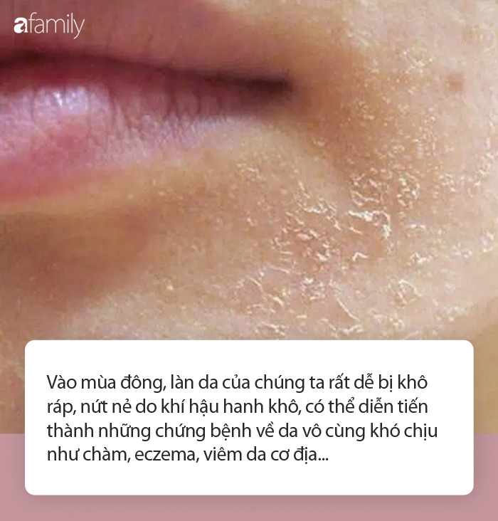 Bôi đủ các loại kem dưỡng mà da vẫn khô, nứt nẻ: Chuyên gia Đông y tiết lộ có thể chế độ ăn của bạn không có 3 thực phẩm vàng sau! - Ảnh 1.