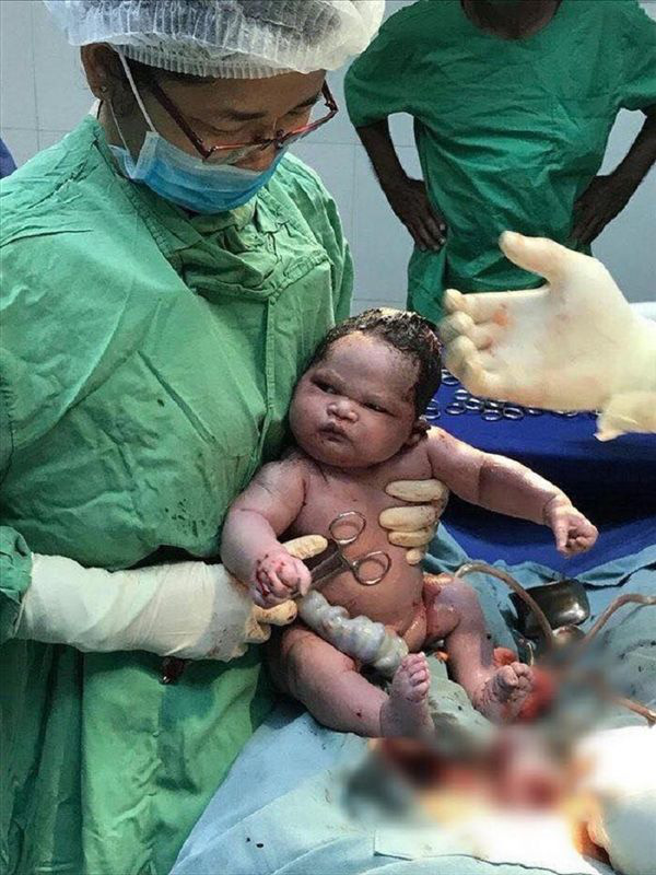 Hình ảnh em bé sơ sinh &quot;lườm xắt xéo&quot; bác sĩ khiến cư dân mạng được một trận cười thả ga - Ảnh 6.