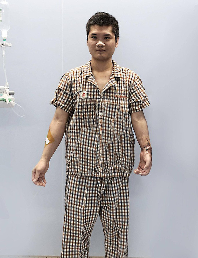 Việt Nam thực hiện thành công ca ghép chi thể đầu tiên trên thế giới từ người hiến sống - Ảnh 3.