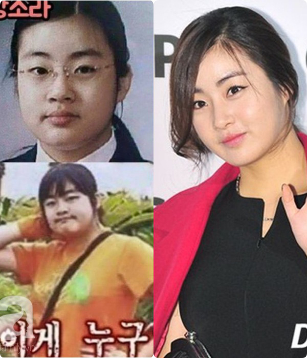 Kang Sora giảm 20kg từ &quot;cô nàng đô con&quot; mặc váy chật đến bục chỉ ngay trên thảm đỏ, lột xác thành mỹ nhân có đôi chân đẹp nhất xứ Hàn - Ảnh 1.