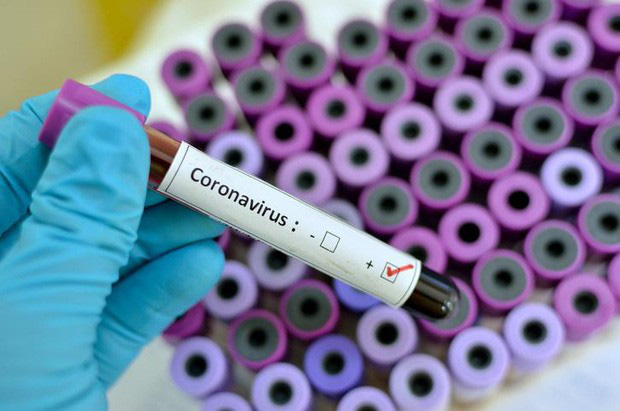 Nhóm nghiên cứu Hà Lan tìm ra kháng thể chống virus corona - Ảnh 1.