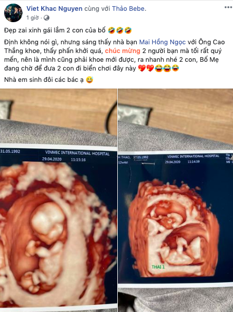 Sau Đông Nhi - Ông Cao Thắng, ca sĩ Khắc Việt cũng báo tin vui bà xã đang mang thai đôi, lý do công bố khiến ai cũng phì cười  - Ảnh 1.