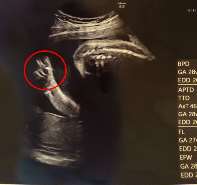Hình ảnh siêu âm chụp lại khoảnh khắc đặc biệt của em bé "đốn tim" hàng nghìn người vì quá đặc biệt - Ảnh 1.