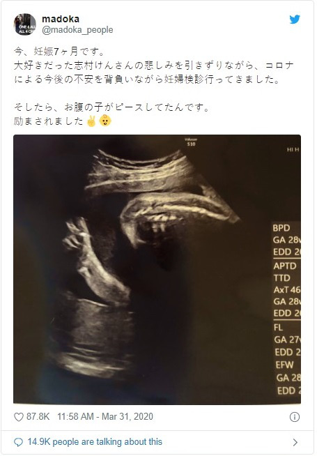 Hình ảnh siêu âm chụp lại khoảnh khắc đặc biệt của em bé "đốn tim" hàng nghìn người vì quá đặc biệt - Ảnh 2.