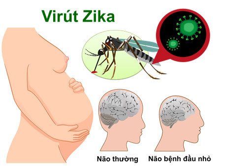 Phát hiện 1 nam thanh niên ở Đà Nẵng mắc virus Zika: Bệnh do virus Zika là gì và nguy hiểm như thế nào? - Ảnh 2.