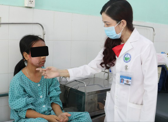 Nữ bệnh nhân 17 tuổi bị hủy hoại da mặt do sử dụng sản phẩm lột thay da sinh học collagen - Ảnh 1.