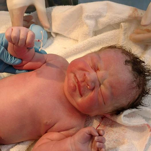 Bé sơ sinh chào đời ở một bệnh viện sản ở Hải Phòng gây sốt với chiếc vòng tránh thai trong tay - Ảnh 4.