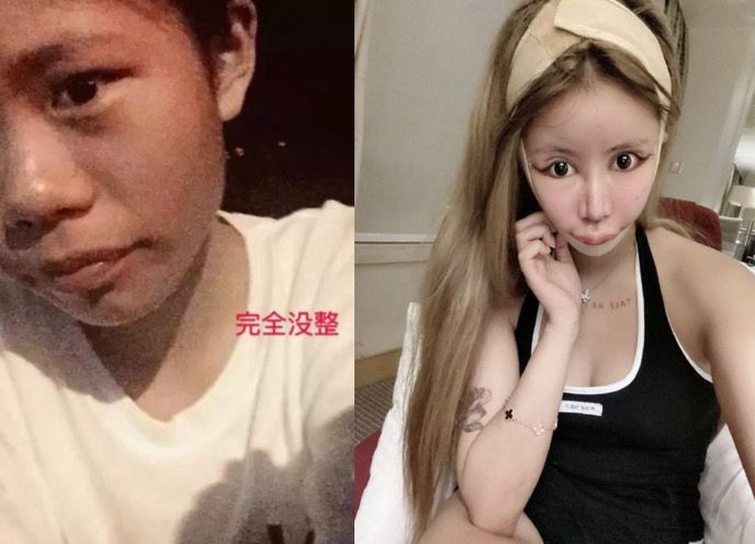 Dân tình khiếp vía khi nhìn gương mặt mẫu nữ Trung Quốc 16 tuổi sau 70 lần phẫu thuật thẩm mỹ, mắt mũi miệng chẳng liên quan đến nhau - Ảnh 2.