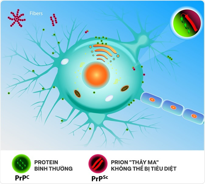 Những cái chết thầm lặng vì nhiễm prion: Phân tử thây ma âm thầm biến não bộ thành bọt biển - Ảnh 9.