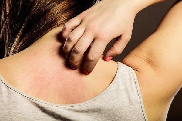 Sau 50 tuổi, 4 căn bệnh ngoài da nguy hiểm này sẽ lần lượt tấn công người già, nhận biết sớm để phòng tránh kẻo muộn - Ảnh 3.