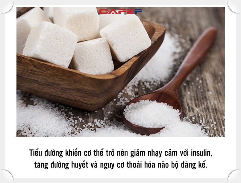 3 món khoái khẩu nhưng khiến não ngày càng teo tóp: Không muốn lão hóa não như người già thì nên lưu ý ngay - Ảnh 1.