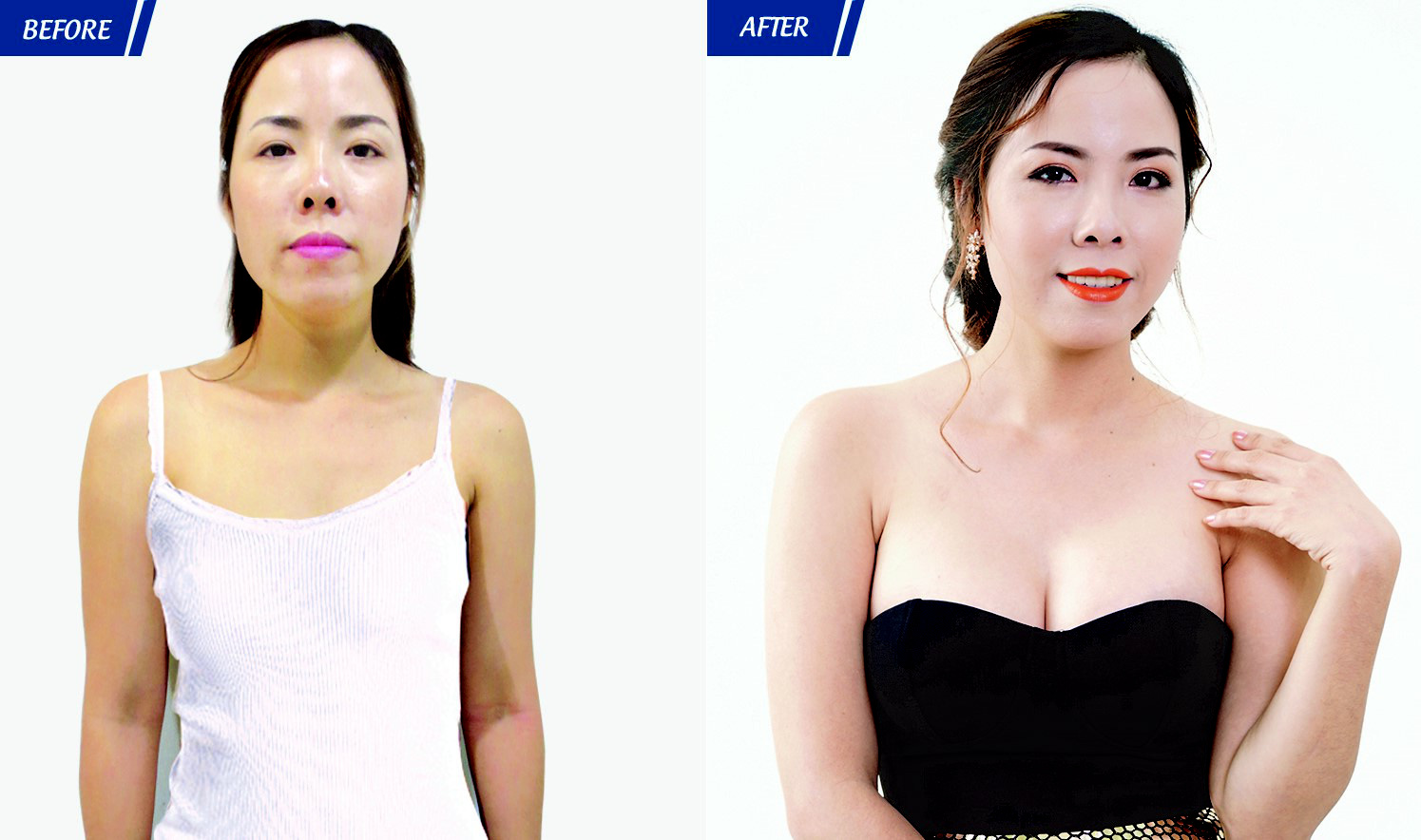 Chuyên gia vạch trần sự thật tàn nhẫn về nạn “thẩm mỹ chui” - Ảnh 3.