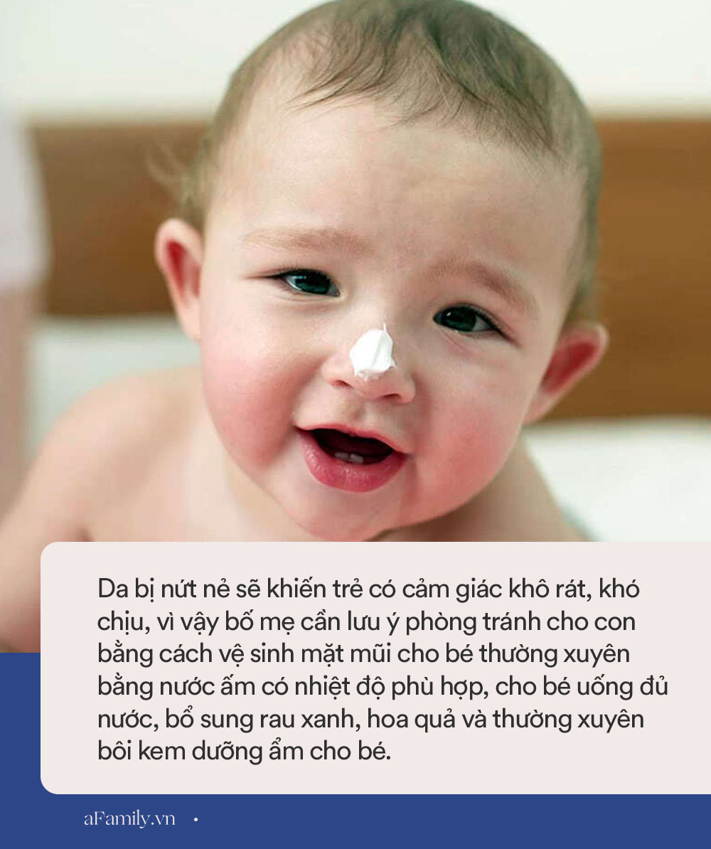 Bé Leon nhà Hồ Ngọc Hà đi Đà Lạt về bỗng gặp một vấn đề về da, các mẹ lưu ý để tránh cho bé - Ảnh 3.