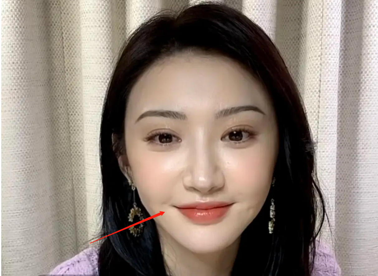 Cảnh Điềm phẫu thuật thẩm mỹ để có miệng giống Angelababy? - Ảnh 1.