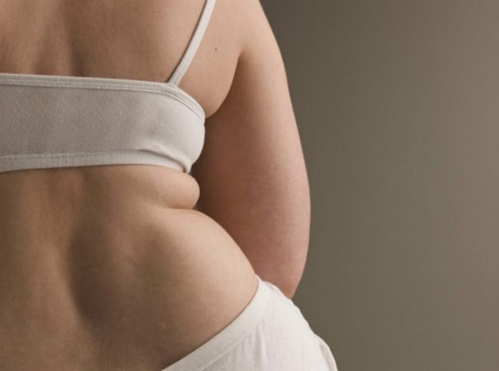 Phụ nữ béo ở 2 chỗ này, chủ yếu liên quan đến bệnh tử cung, tránh giảm cân bừa bãi - Ảnh 1.