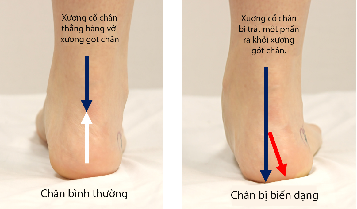 Bà mẹ tá hỏa khi thấy chân con trai 4 tuổi bị biến dạng, còn bà ngoại khóc hết nước mắt vì hối hận - Ảnh 2.