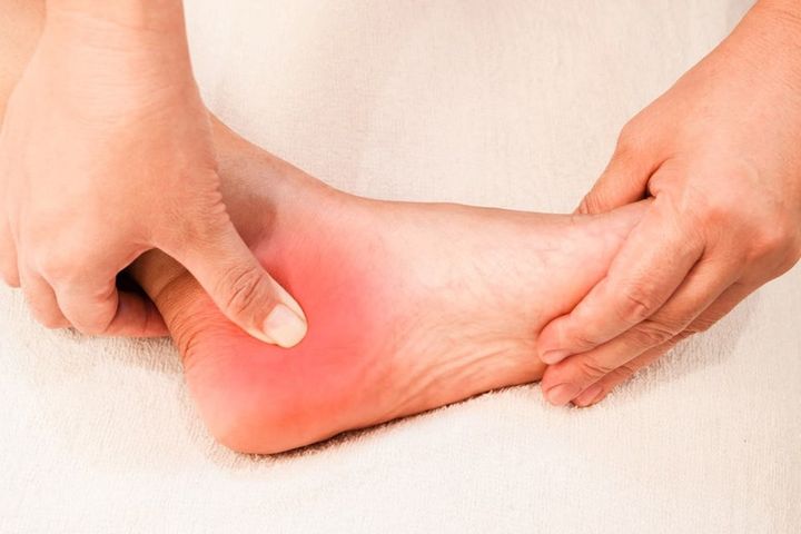 Nhìn bàn chân đoán bệnh, có 4 điểm bất thường trên bàn chân, cần đi khám thận khẩn cấp - Ảnh 3.