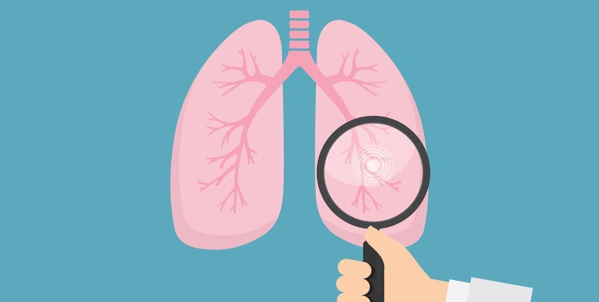 Bác sĩ nhắc nhở: Nhận thấy 4 điều bất thường này ở tay thì có thể phổi đang “kiệt quệ”, nặng hơn có thể dẫn đến ung thư - Ảnh 3.
