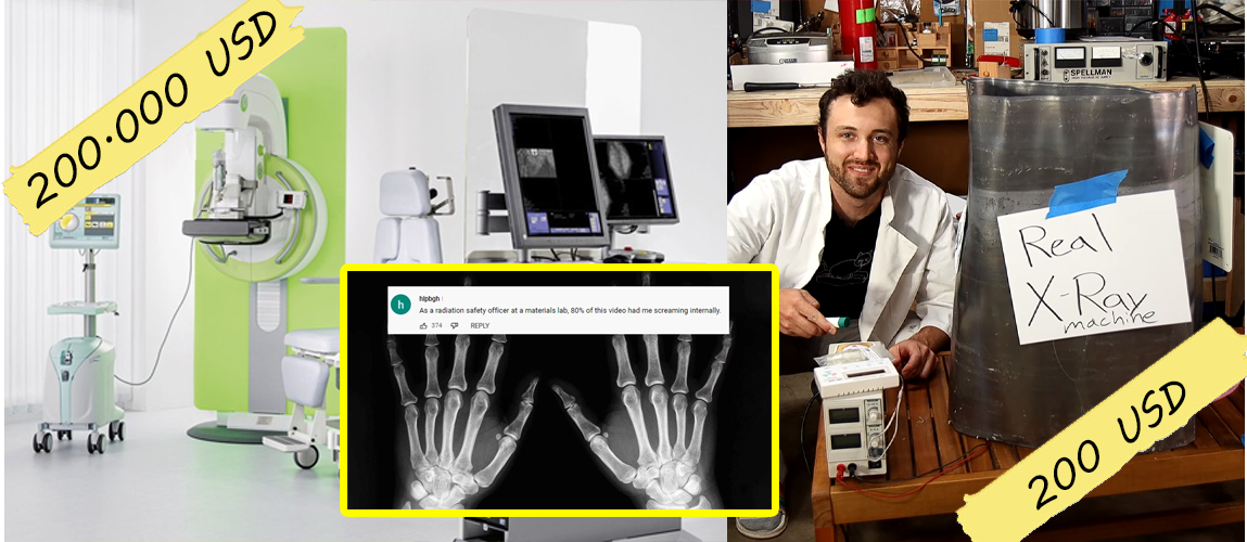 Phải đóng gần 1,6 tỷ đồng tiền viện phí, anh chàng bức xúc về nhà đăng lên YouTube tuyên bố tự tay lắp chiếc máy X-quang tại nhà và kết quả bất ngờ - Ảnh 1.