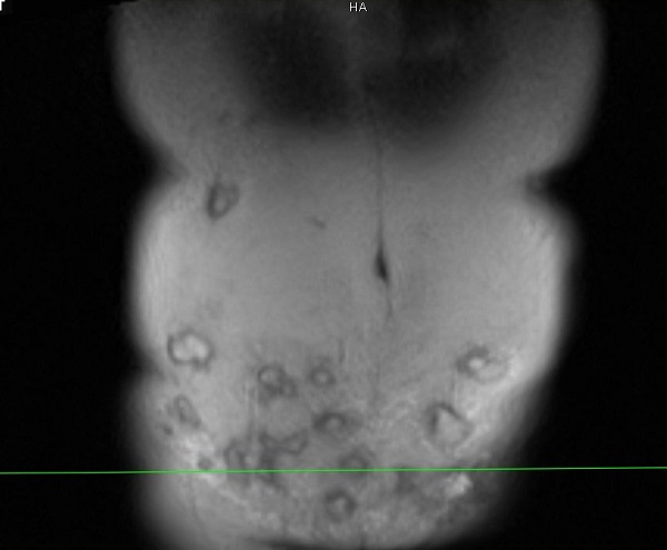 Chuyên gia cảnh báo: Tiêm tiêu mỡ "ăn thủng" cơ thể người phụ nữ sau khi làm đẹp - Ảnh 1. Chuyên gia cảnh báo: Tiêm tiêu mỡ "ăn thủng" cơ thể người phụ nữ sau khi làm đẹp - Ảnh 1.