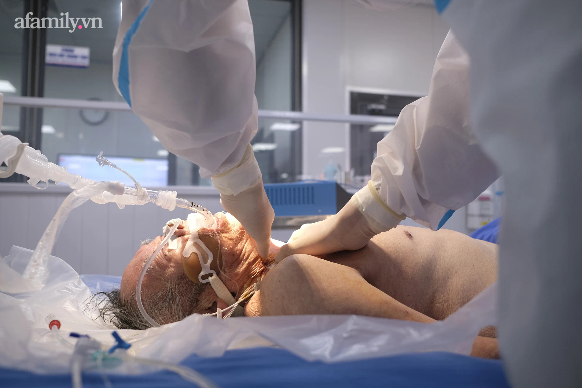 Chuyên gia: Di chứng hậu Covid-19 đáng lo ngại nhưng không nên hoảng sợ nó để rồi bị nặng thêm - Ảnh 2. Chuyên gia: Di chứng hậu Covid-19 đáng lo ngại nhưng không nên hoảng sợ nó để rồi bị nặng thêm - Ảnh 2.