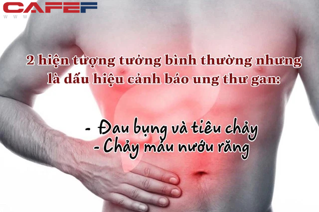 Nữ quản lý 31 tuổi bị ung thư gan nhưng không đau, không ngứa: Bác sĩ chỉ ra dấu hiệu đỏ hút cạn nguồn sống trên cơ thể nhưng nhiều người chủ quan bỏ qua - Ảnh 2.