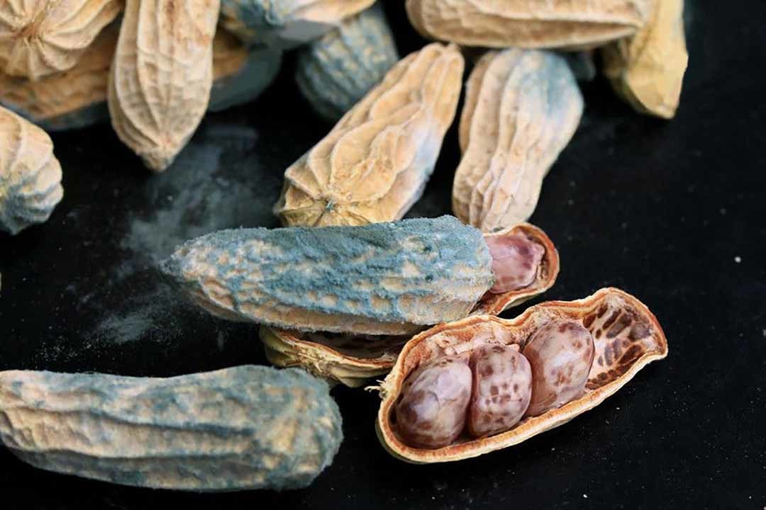 Nữ quản lý 31 tuổi bị ung thư gan nhưng không đau, không ngứa: Bác sĩ chỉ ra dấu hiệu đỏ hút cạn nguồn sống trên cơ thể nhưng nhiều người chủ quan bỏ qua - Ảnh 4.