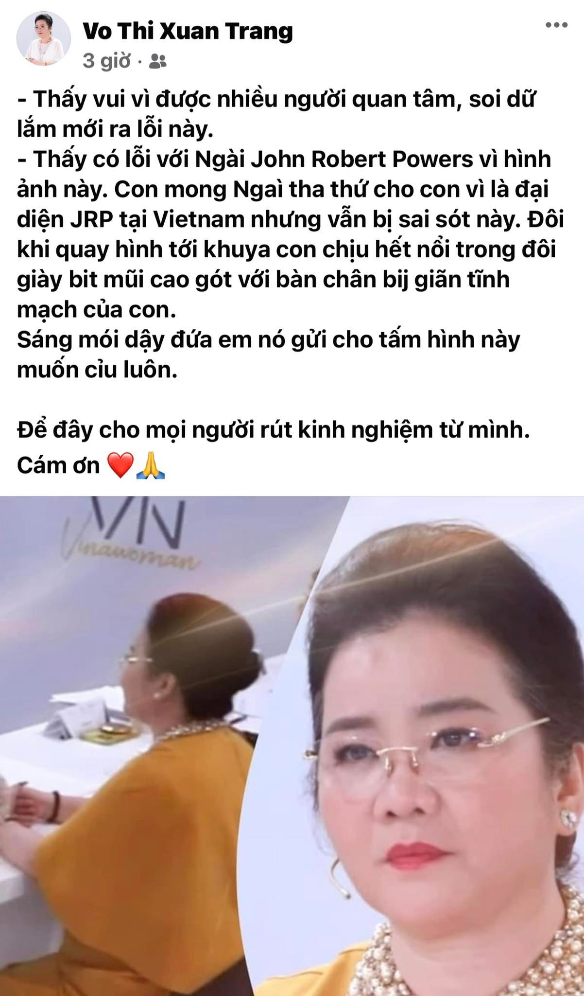 Cô Xuân Trang lên tiếng sau khi bị soi lỗi ở Hoa Hậu Hoàn Vũ, hé lộ bệnh tình đáng chú ý - Ảnh 3.