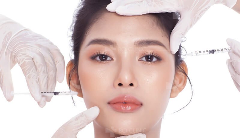 Top 3 vị trí tiêm filler giúp chị em lột xác, mặt xinh như baby nhưng cực kỳ ít người biết - Ảnh 4.