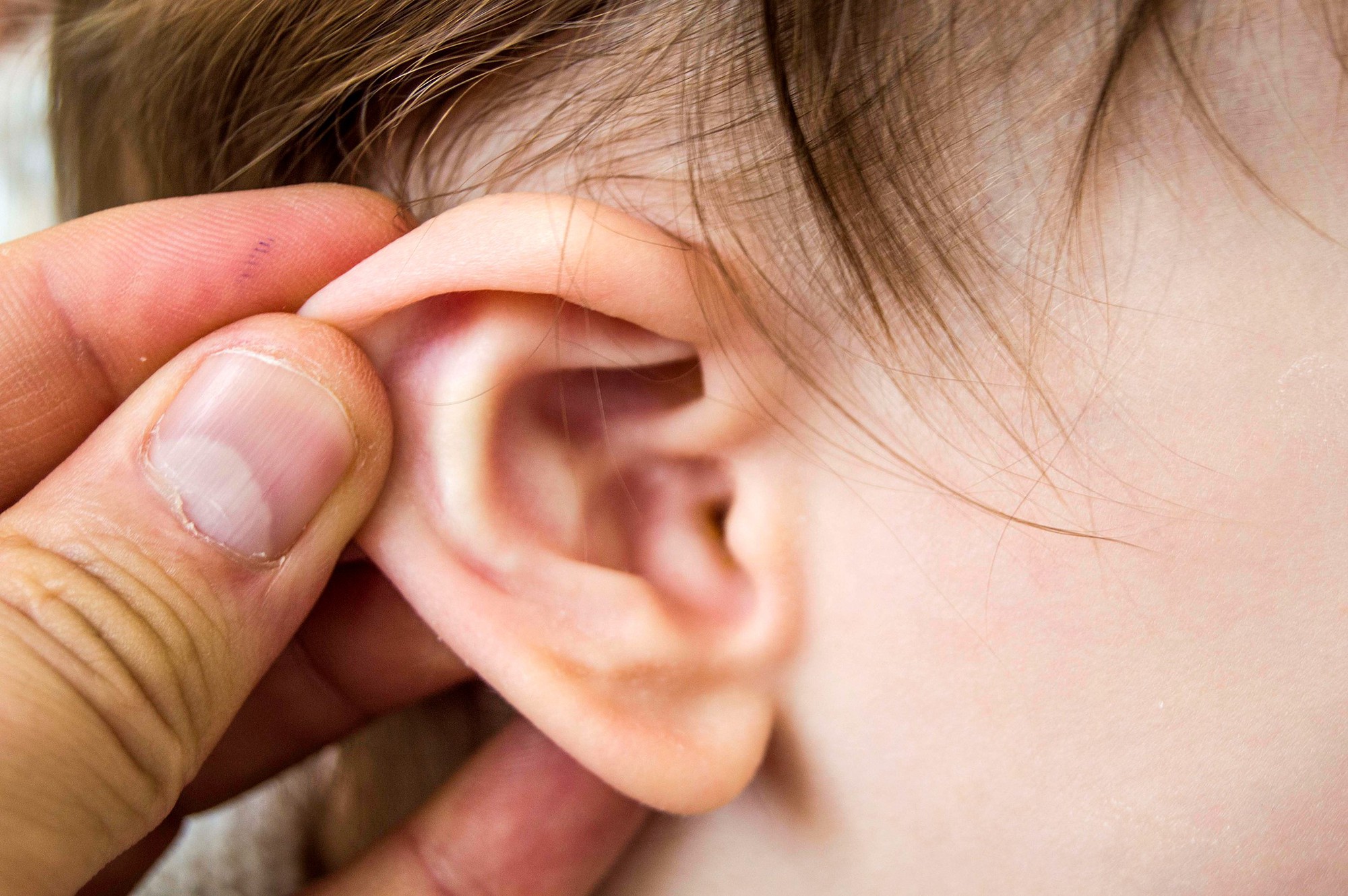 Đeo tai nghe nhiều có những ảnh hưởng tiêu cực ra sao? Sau đây là câu trả lời cho bạn - Ảnh 5.