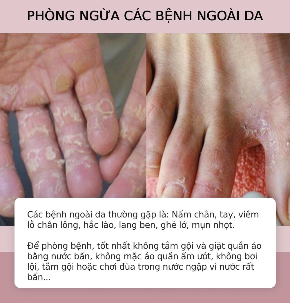 Để Phòng Ngừa Các Bệnh Ngoài Da: Hướng Dẫn Chi Tiết và Hiệu Quả