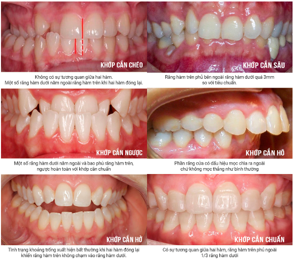 5 phút kiểm tra tình trạng răng của bạn - Ảnh 1.