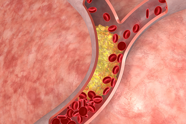 5 hành động là 'khắc tinh' của mỡ máu, làm đúng chẳng sợ cholesterol cao - Ảnh 1.