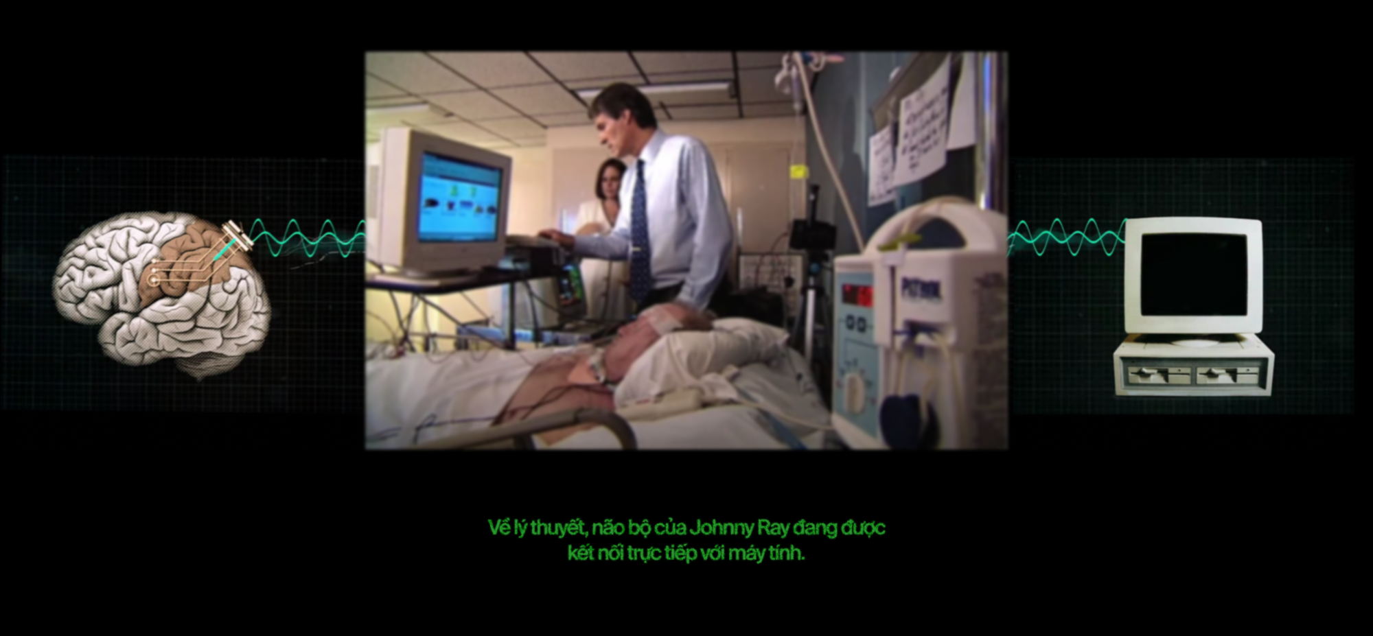 Bệnh nhân 23: Anh có muốn được chết không? Đây là cách những cỗ máy đọc suy nghĩ giúp người bị &quot;nhốt hồn&quot; cất tiếng nói - Ảnh 23.