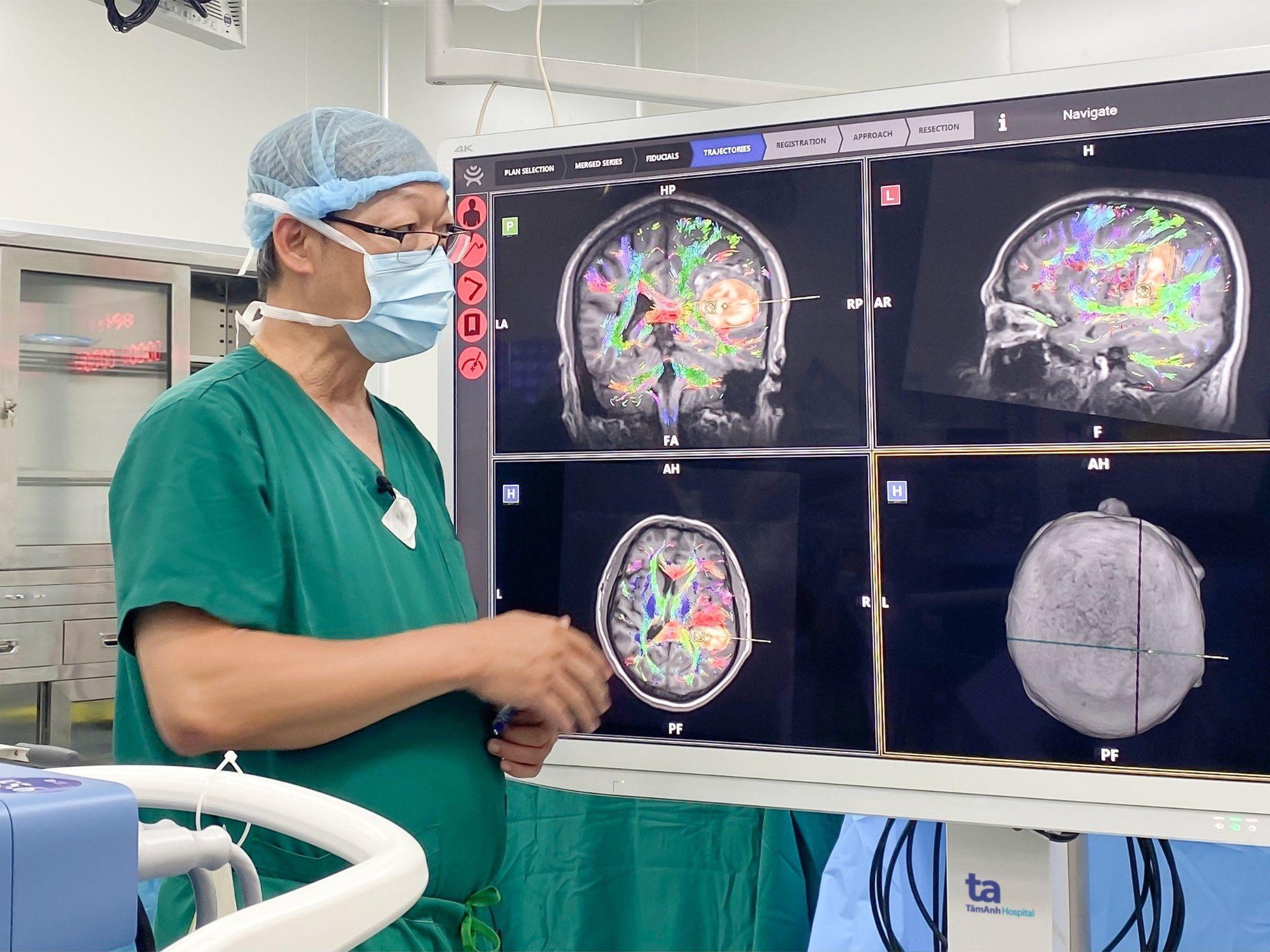 Một bệnh viện ở Việt Nam mổ não tỉnh thức bằng robot AI: bệnh nhân hát trong lúc đang mổ - Ảnh 1.