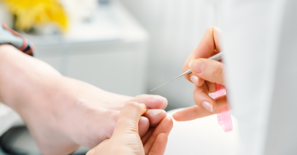 3 thay đổi ở móng chân báo hiệu vấn đề sức khỏe, một trong số đó cảnh báo loại ung thư khó phát hiện