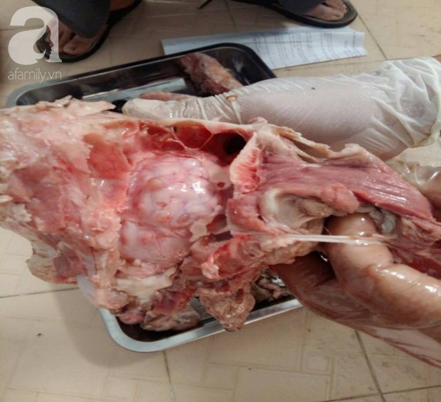 Nguy hiểm: Phát hiện ổ bệnh sán dây lợn, ít nhất 108 người mắc ở Bình Phước nghi do ăn thịt sống  - Ảnh 1.