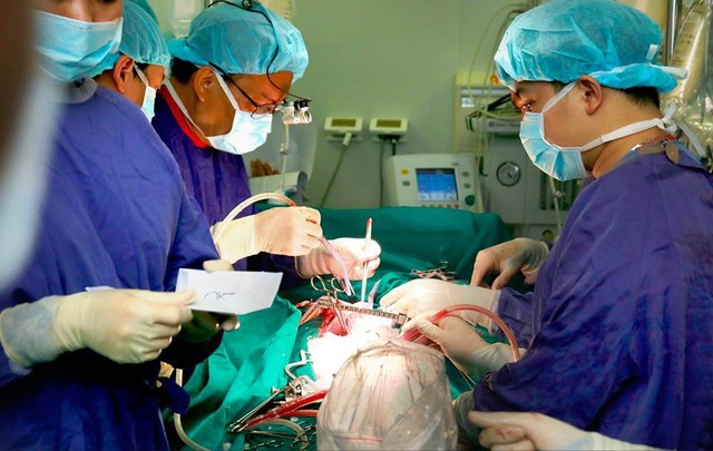 Lần đầu tiên ở Việt Nam: Bác sĩ ghép 5 tạng cùng một thời điểm cho 4 bệnh nhân - Ảnh 1.