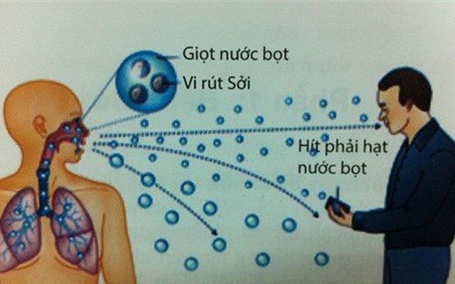 Vắc-xin có thể bảo vệ khỏi bệnh sởi, nhưng bạn cũng cần biết bệnh sởi lây qua đường nào - Ảnh 3.