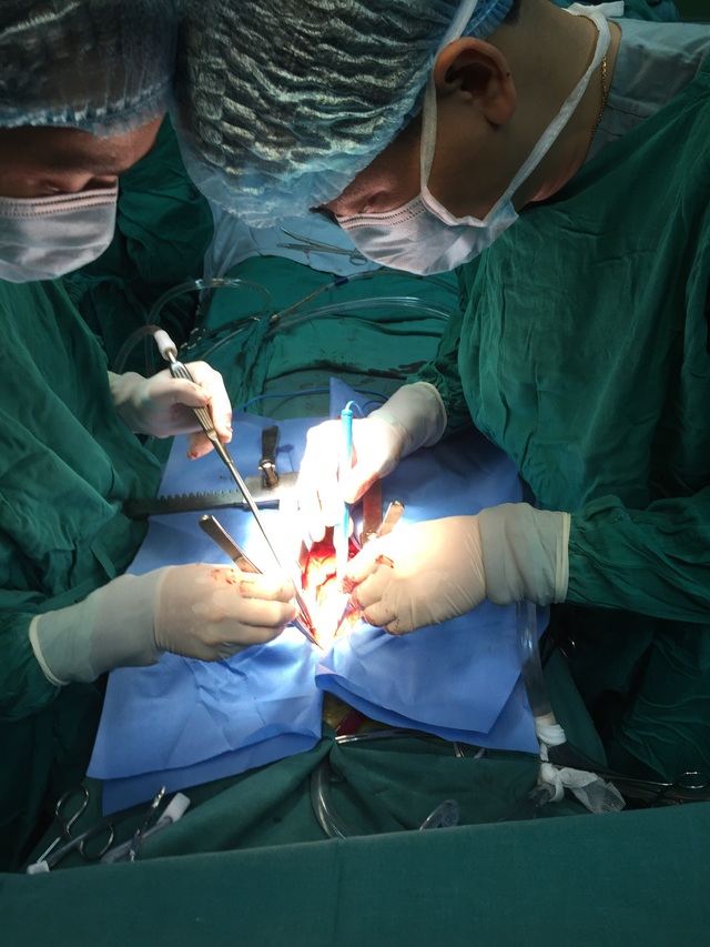 Gần 8 giờ phẫu thuật cứu sống bệnh nhân phình lóc tách thành động mạch chủ ngực cấp tính type A - Ảnh 1.
