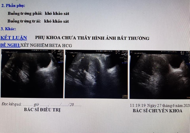 Người phụ nữ nhập viện để chờ sinh nhưng nhận kết quả bất ngờ - Ảnh 1.