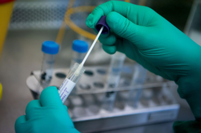 Bộ Y tế ban hành kế hoạch xét nghiệm phát hiện nhiễm SARS-CoV-2 trong tình hình mới - Ảnh 1.