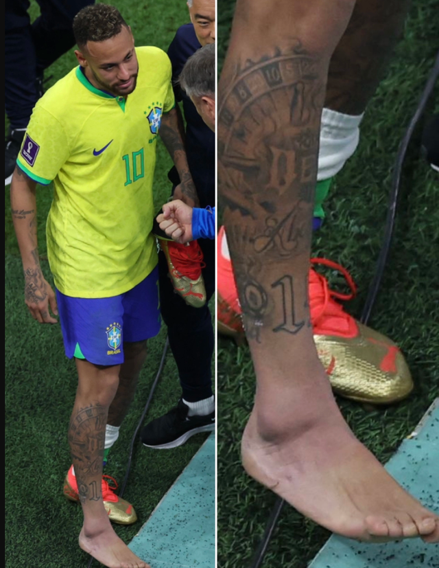 Để &quot;cứu&quot; Brazil, Neymar có thể tiêm giảm đau, mặc đồ bảo hộ để ra sân - Ảnh 2.