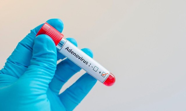 Adenovirus tiếp tục chạm mốc hơn 1.400 ca, 7 trẻ tử vong: Cha mẹ cần phân biệt rõ với bệnh hô hấp thông thường - Ảnh 2.