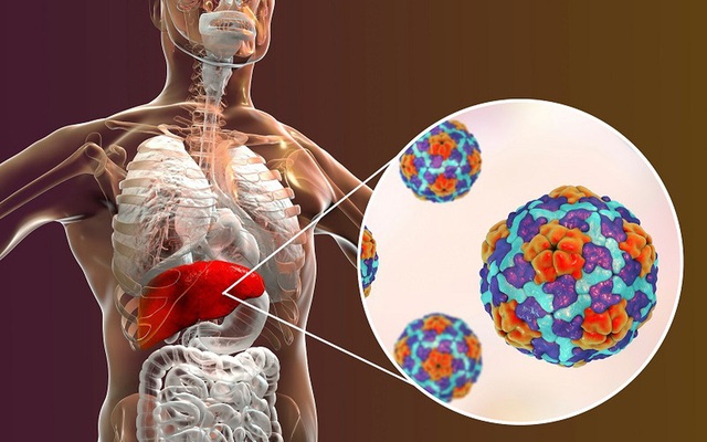 Bệnh gan đang gia tăng: Chuyên gia chỉ ra lưu ý để bảo vệ “nhà máy hóa chất” của cơ thể - Ảnh 2.