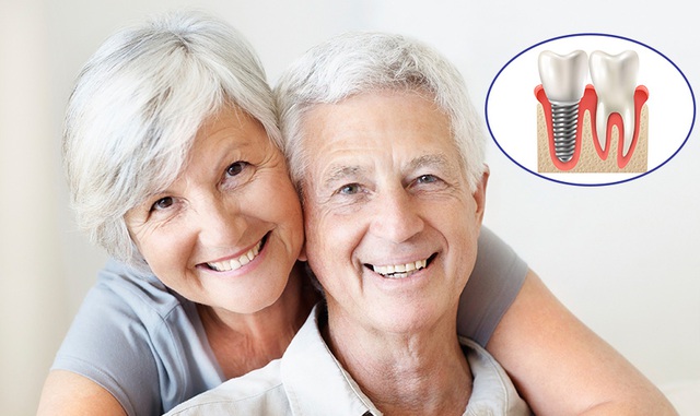 Phát hiện mối quan hệ giữa số răng và tuổi thọ: Người nhiều hay ít răng sẽ sống thọ hơn?   - Ảnh 2.