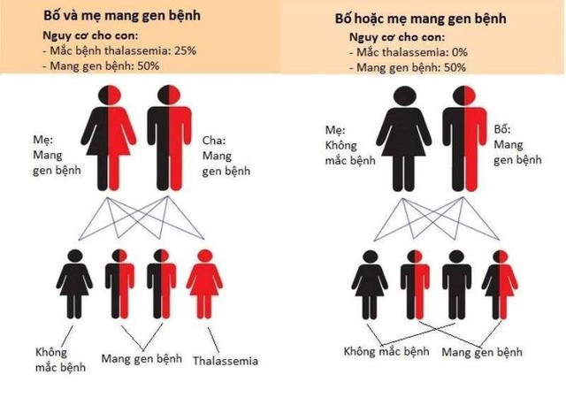 Thalassemia - căn bệnh khiến trẻ thiếu máu nhưng thừa sắt bẩm sinh - Ảnh 2.